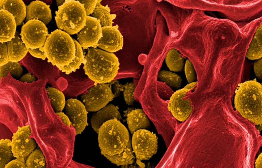 ¿qué Son Las Superbacterias Y Cómo Puedo Protegerme De Las Infeccionesemk 1427