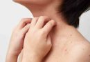 Dermatitis atópica: el drama de los niños que no pueden dormir a causa de esta enfermedad