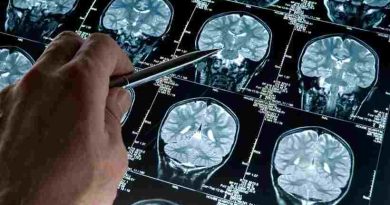 ¿A qué edad comienza la enfermedad de Alzheimer? 