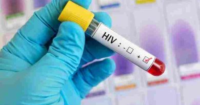 La ONU aspira a poner fin al SIDA como amenaza para la salud en 2030