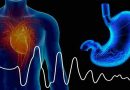 Cirugía Metabólica: una opción que mejora la Diabetes en pacientes con sobrepeso y obesidad