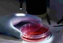 Es posible detectar el riesgo de leucemia con un examen de sangre