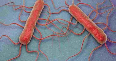 Confirman un brote de listeriosis por el consumo de un queso contaminado