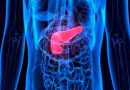 Enfoques mínimamente invasivos reducen el tiempo de recuperación en las cirugías de cáncer de páncreas