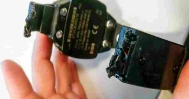 Río Negro: Un joven fue imputado por cortarse la tobillera electrónica