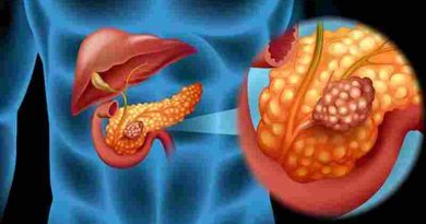 Cáncer de páncreas: científicos españoles lograron eliminarlo en un estudio con ratones