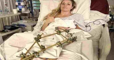 El emotivo mensaje de Cristiano Ronaldo a una atleta que sufrió una escalofriante lesión