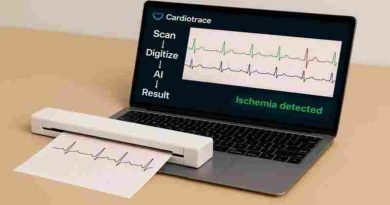 Argentinos crearon un escáner con IA que ayuda a prevenir infartos