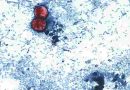 Estados Unidos: reportan las primeras dos muertes por brote de ciclosporiasis
