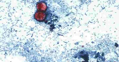 Estados Unidos: reportan las primeras dos muertes por brote de ciclosporiasis