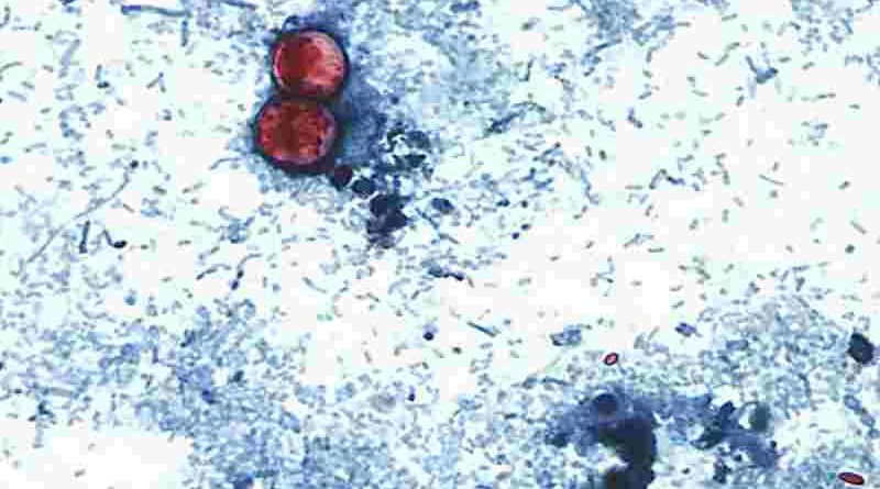 Estados Unidos: reportan las primeras dos muertes por brote de ciclosporiasis