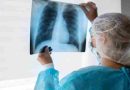 Peste neumónica: La muerte de una técnica de laboratorio en Rusia encendió las alarmas