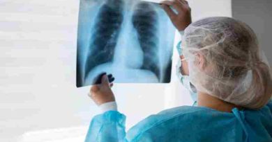 Peste neumónica: La muerte de una técnica de laboratorio en Rusia encendió las alarmas