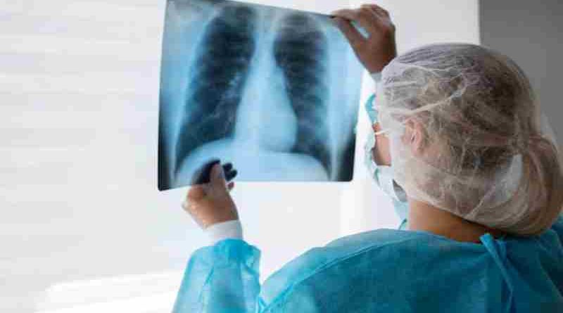 Peste neumónica: La muerte de una técnica de laboratorio en Rusia encendió las alarmas